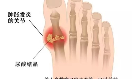 肌炎病人哪些食物能吃呢-肌炎病人哪些食物能吃网肌炎不能吃的食物知识网站,分享肌炎病人不能吃的东西大全